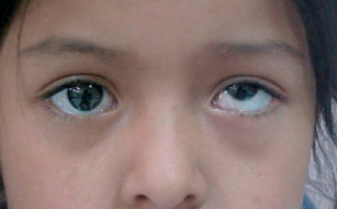 Eye Hospital in Thrissur