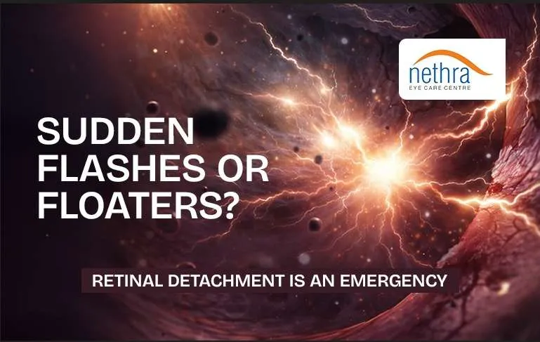 Eye Care Blogs on LASIK Cataract and Squint Treatment by Nethra Eye Care Centre