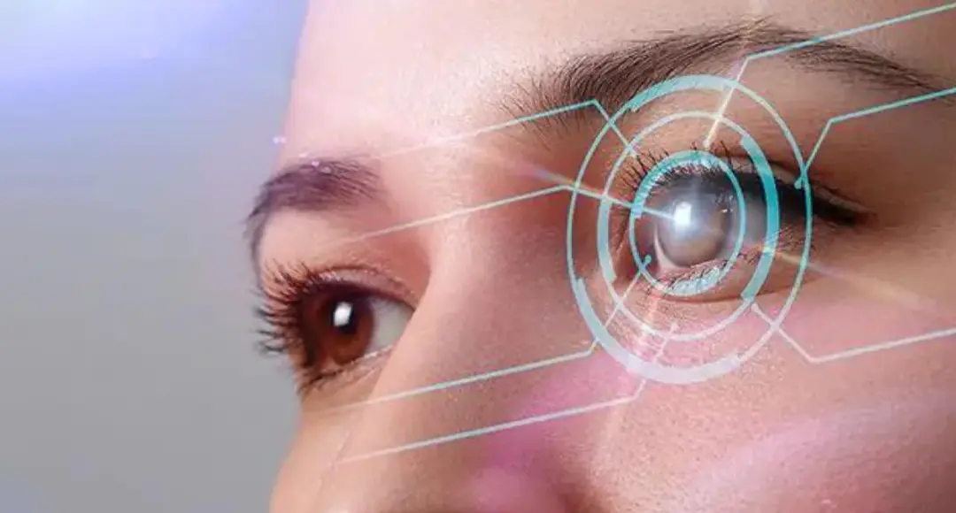 Lasik Surgery